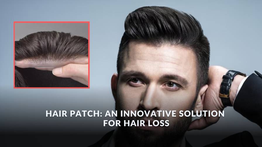 Hair Patch An Innovative Solution for Hair Loss